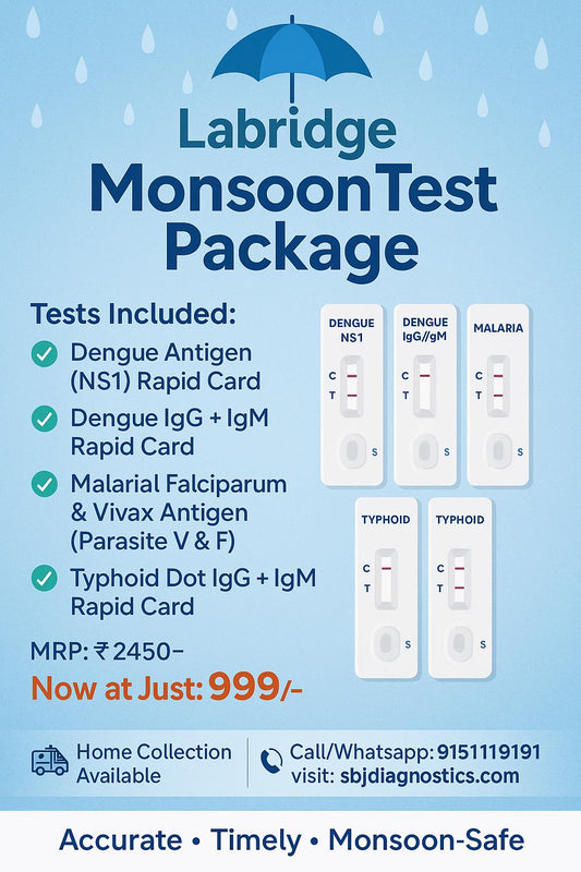 Labridge Monsoon Test Package